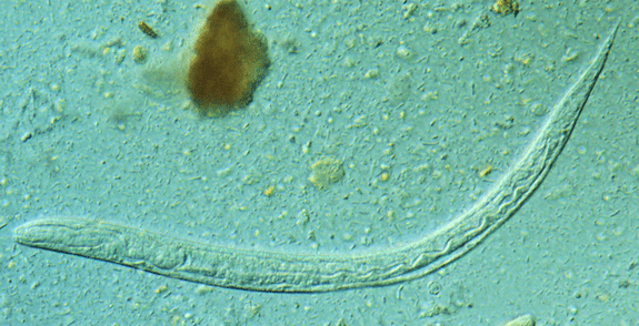 Strongyloides larva Strongyloides larva