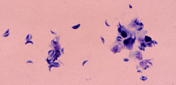Toxoplasma gondii Toxoplasma gondii